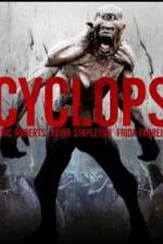 Cyclops