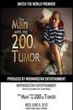 Watch The Man With The 200lb Tumor 123movies