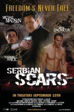 Serbian Scars