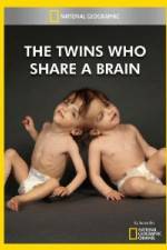 National Geographic The Twins Who Share A Brain